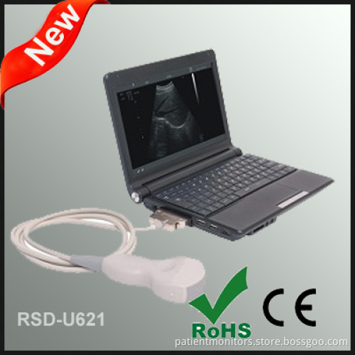 Laptop Ultrasonic Diagnostic System Scanner
